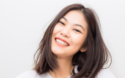 Dental Implants or Veneers – Which Is Right for Me?